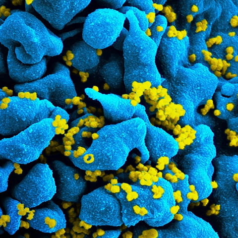 Smittsamt – miniutställning om virus, pandemier och Nobelpris