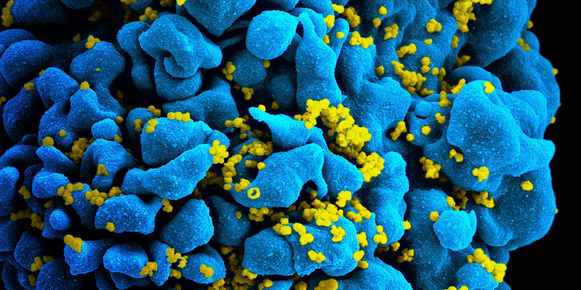 Smittsamt – miniutställning om virus, pandemier och Nobelpris