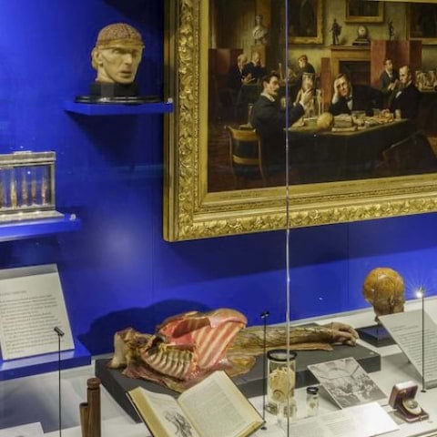 The Hunterian Museum is reopening after a six year absence