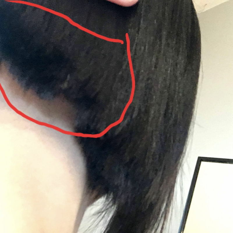 Toppar underifrån, höger sida. Håret inom markeringen är upplyft för att visa tjockleken. – Bild från Hair Angered av Alma S.