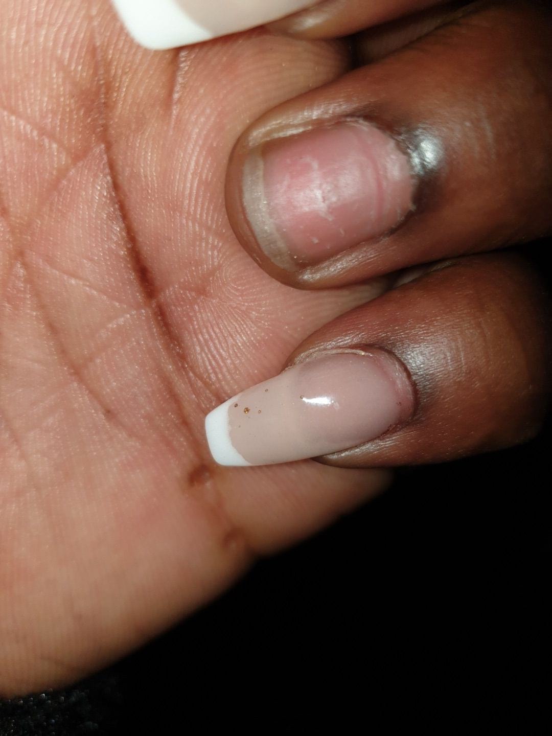 Här ser ni linjen på min nagel och vattenbubblorna – Photo from Hollywood Nails Center by Natacha M. (06/10/2019)